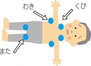 熱中症の応急処置